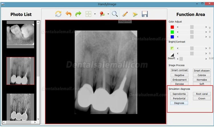 High Resolution Digital USB Type Dental X Ray Sensor Rvg HDR 500